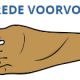 Brede voeten